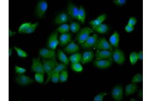 Immunofluorescence staining of A549 cells with ABIN7174389 at 1:166, counter-stained with DAPI.