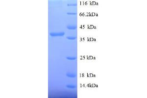 SDS-PAGE (SDS) image for Signal Recognition Particle 14kDa (Homologous Alu RNA Binding Protein) (SRP14) (AA 2-108), (partial) protein (GST tag) (ABIN5712261)