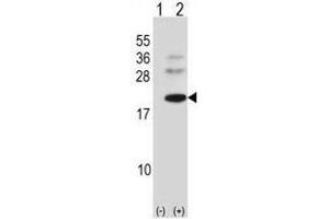 Western blot analysis of BARX1 (arrow) using rabbit polyclonal BARX1 Antibody (C-term) . (BARX1 antibody  (C-Term))