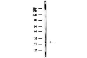 Western blot analysis of lysates from EC304 cells(heat-shock,45 min treatment), using RABL2A Antibody at 1/1000 dilution.