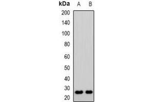 Western blot analysis of CD53 expression in KB (A), Jurkat (B) whole cell lysates. (CD53 antibody)