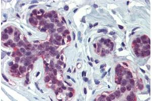 Breast, Human: Formalin-Fixed, Paraffin-Embedded (FFPE) (CBP antibody  (AA 144-193))