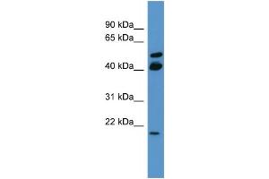 WB Suggested Anti-RERG Antibody Titration: 0. (RERG antibody  (C-Term))