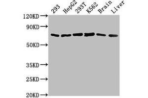 Western Blot Positive WB detected in: 293 whole cell lysate, HepG2 whole cell lysate, 293T whole cell lysate, K562 whole cell lysate, Mouse brain tissue, Mouse liver tissue All lanes: HSPD1 antibody at 1:2000 Secondary Goat polyclonal to rabbit IgG at 1/50000 dilution Predicted band size: 62, 18 kDa Observed band size: 62 kDa (HSPD1 antibody  (AA 225-573))