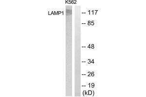 Western blot analysis of extracts from K562 cells, using LAMP1 antibody. (LAMP1 antibody  (Internal Region))