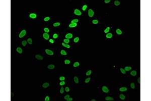 Immunofluorescence staining of Hela cells with ABIN7139600 at 1:5, counter-stained with DAPI. (H2AFZ antibody  (meLys4))
