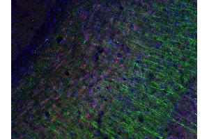 Indirect immunostaining of PFA fixed mouse brain sections with anti-Tbr 1 (dilution 1 : 200; red) and mouse anti-MAP 2 (, dilution 1 : 200; green).