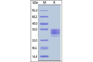 Fc gamma RIV / CD16-2 (AA 21-203) protein (His tag)