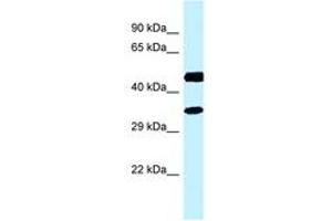 Image no. 1 for anti-Retinol Dehydrogenase 13 (All-Trans and 9-Cis) (RDH13) (C-Term) antibody (ABIN6747749) (RDH13 antibody  (C-Term))