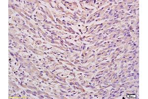 Formalin-fixed and paraffin embedded mouse embryo tissue labeled with Anti EPHX2 Polyclonal Antibody,Unconjugated (ABIN750553) at 1:200 followed by conjugation to the secondary antibody and DAB staining. (EPHX2 antibody  (AA 351-450))