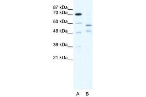 TRIM23 antibody (20R-1190) used at 0. (TRIM23 antibody  (C-Term))