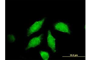 Immunofluorescence of purified MaxPab antibody to WNT3A on HeLa cell.