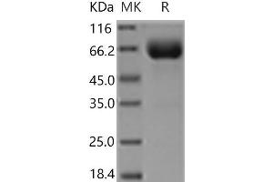 Western Blotting (WB) image for Growth Hormone Receptor (GHR) (Active) protein (Fc Tag) (ABIN7321235) (Growth Hormone Receptor Protein (GHR) (Fc Tag))