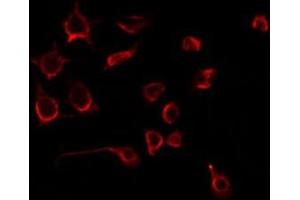 ABIN6275753 staining 293 by IF/ICC. (PLAGL1 antibody  (Internal Region))