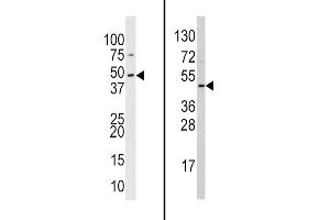 Western blot analysis of anti-hSUV39H2- Pab (Cat. (SUV39H2 antibody  (C-Term))