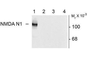 Image no. 1 for anti-NMDA Receptor 1 (NMDA R1) (Splice Variant N1) antibody (ABIN372678) (NMDA 1 Receptor antibody  (Splice Variant N1))