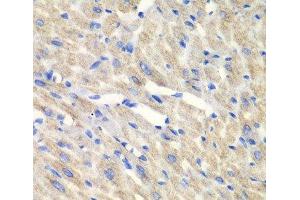 Immunohistochemistry of paraffin-embedded Mouse heart using CARS Polyclonal Antibody at dilution of 1:100 (40x lens). (CARS antibody)