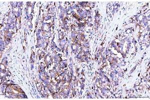 IHC analysis of Poliovirus Receptor/PVR using anti-Poliovirus Receptor/PVR antibody (ABIN7601072).