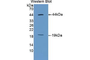 Figure. (Ki-67 antibody  (AA 2386-2674))