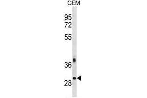 TRA2B Antibody (Center) western blot analysis in CEM cell line lysates (35 µg/lane). (TRA2B antibody  (Middle Region))