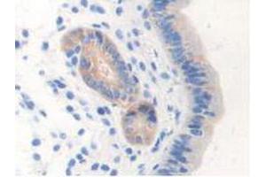 IHC-P analysis of Mouse Uterus Tissue, with DAB staining. (NOS1 antibody  (AA 53-247))