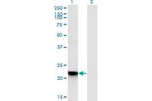 Western Blot analysis of RGS5 expression in transfected 293T cell line by RGS5 monoclonal antibody (M01), clone 4E12. (RGS5 antibody  (AA 94-181))