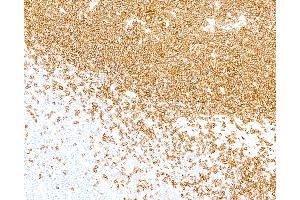 Immunohistochemistry (IHC) image for anti-Fluorescein Isothiocyanate (FITC) antibody (ABIN7795714) (Recombinant FITC antibody)