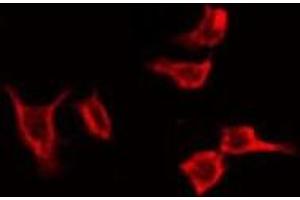 ABIN6274227 staining Hela by IF/ICC. (Coronin 1a antibody  (Internal Region))