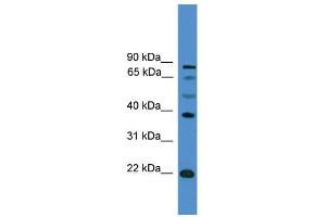 WB Suggested Anti-ASCL2  Antibody Titration: 0.