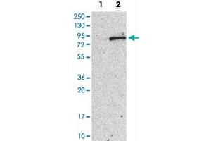 Western Blot analysis of Lane 1: negative control (vector only transfected HEK293T cell lysate) and Lane 2: over-expression lysate (co-expressed with a C-terminal myc-DDK tag in mammalian HEK293T cells) with TEC polyclonal antibody . (NR4A3 antibody)