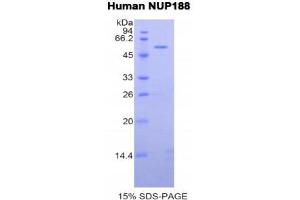 SDS-PAGE (SDS) image for Nucleoporin 188kDa (NUP188) (AA 540-782) protein (His tag,GST tag) (ABIN1099348) (NUP188 Protein (AA 540-782) (His tag,GST tag))