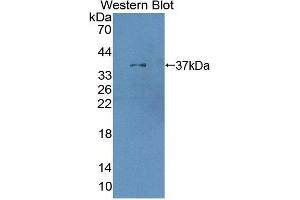 Detection of Recombinant XRN1, Human using Polyclonal Antibody to 5'-3'Exoribonuclease 1 (XRN1) (XRN1 antibody  (AA 1394-1706))