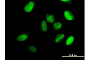 Immunofluorescence of purified MaxPab antibody to KIF22 on HeLa cell. (KIF22 antibody  (AA 1-665))