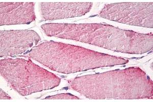 Human Skeletal Muscle: Formalin-Fixed, Paraffin-Embedded (FFPE) (CPNE6 antibody)