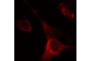 ABIN6275285 staining Hela cells by IF/ICC.