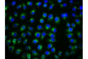 Immunofluorescence staining of A549 cells with ABIN7171846 at 1:133, counter-stained with DAPI. (TSPAN12 antibody  (AA 111-224))
