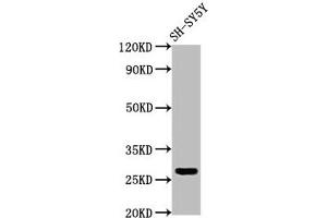 Western Blot Positive WB detected in: SH-SY5Y whole cell lysate All lanes: CD99L2 antibody at 4 μg/mL Secondary Goat polyclonal to rabbit IgG at 1/50000 dilution Predicted band size: 28, 23, 21, 16, 29 kDa Observed band size: 28 kDa (CD99L2 antibody  (AA 26-145))