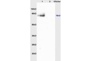 L1 mouse brain lysates L2 mouse heart lysates probed with Anti MMP9 Polyclonal Antibody, Unconjugated (ABIN873171) at 1:200 overnight at 4 °C. (MMP 9 antibody  (AA 151-250))