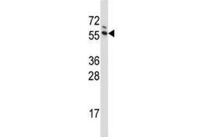 G3BP1 antibody western blot analysis in Jurkat lysate (G3BP1 antibody  (AA 401-430))