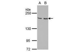 Image no. 1 for anti-Kinesin Family Member 14 (KIF14) (N-Term) antibody (ABIN1494038) (KIF14 antibody  (N-Term))