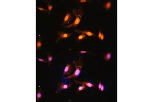 Immunofluorescence analysis of U2OS cells using FLCN antibody (ABIN7267226) at dilution of 1:100. (FLCN antibody  (AA 1-130))