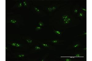 Immunofluorescence of purified MaxPab antibody to PNO1 on HeLa cell. (PNO1 antibody  (AA 1-252))