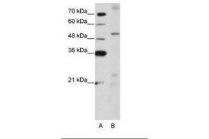 Image no. 1 for anti-Zinc Finger Protein 596 (ZNF596) (AA 424-473) antibody (ABIN203183) (ZNF596 antibody  (AA 424-473))