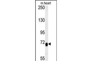 Western blot analysis in mouse heart tissue lysates (15ug/lane). (LCA5L antibody  (C-Term))