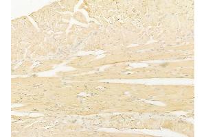 ABIN6266027 and ABIN6267216 at 1/100 staining human tongue carcinoma by IHC-P.