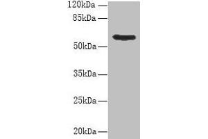 Western blot All lanes: PDIA5 antibody at 8 μg/mL + Hela whole cell lysate Secondary Goat polyclonal to rabbit IgG at 1/10000 dilution Predicted band size: 60, 31 kDa Observed band size: 60 kDa (PDIA5 antibody  (AA 22-262))