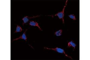 Immunofluorescence analysis of anti-ALDH1A1 antibody and HeLa cells. (ALDH1A1 antibody  (AA 302-331))