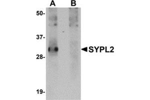 Western Blotting (WB) image for anti-Synaptophysin-Like 2 (SYPL2) (C-Term) antibody (ABIN1030718) (SYPL2 antibody  (C-Term))