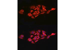 Immunofluorescence analysis of PC-12 cells using IL15RA Rabbit pAb (ABIN3017117, ABIN1680439 and ABIN7101500) at dilution of 1:100 (40x lens). (IL15RA antibody  (AA 31-205))