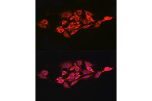 Immunofluorescence analysis of PC-12 cells using IL15RA Rabbit pAb (ABIN3017117, ABIN1680439 and ABIN7101500) at dilution of 1:100 (40x lens). (IL15RA antibody  (AA 31-205))